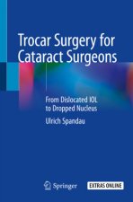 Trocar Surgery for Cataract Surgeons: From Dislocated Iol to Dropped Nucleus