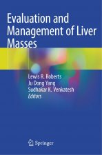 Evaluation and Management of Liver Masses