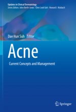 Acne: Current Concepts and Management