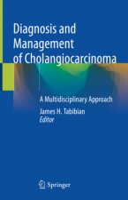 Diagnosis and Management of Cholangiocarcinoma: A Multidisciplinary Approach