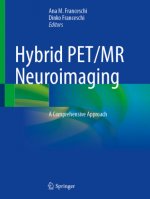Hybrid Pet/MR Neuroimaging: A Comprehensive Approach