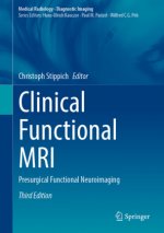 Clinical Functional MRI: Presurgical Functional Neuroimaging