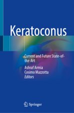 Keratoconus: Current and Future State-Of-The-Art