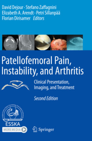 Patellofemoral Pain, Instability, and Arthritis: Clinical Presentation, Imaging, and Treatment