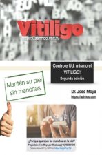 Controle Ud. mismo el Vitiligo