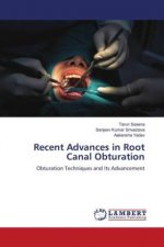 Recent Advances in Root Canal Obturation