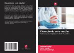 Elevaç?o do seio maxilar