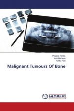 Malignant Tumours Of Bone