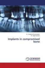 Implants in compromised bone