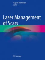Laser Management of Scars