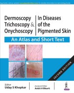 Dermoscopy, Trichoscopy and Onychoscopy in Diseases of the Pigmented Skin