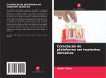 Comutaç?o de plataforma em implantes dentários