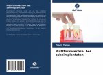 Plattformwechsel bei zahnimplantaten