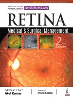 Retina