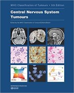 Central Nervous System Tumours: Who Classification of Tumours