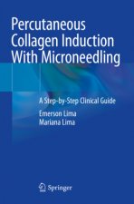 Percutaneous Collagen Induction With Microneedling