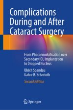 Complications During and After Cataract Surgery