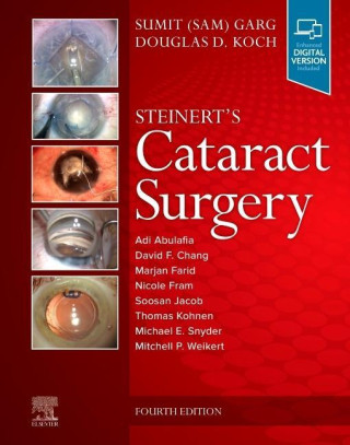 Steinert's Cataract Surgery (Sumit Garg,Douglas D. Koch)(Kemény kötésű)