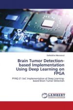 Brain Tumor Detection-based Implementation Using Deep Learning on FPGA