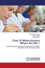Class III Malocclusions Where Are We ?