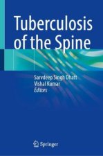 Tuberculosis of the Spine