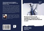 Psihosocial'nyj profil' pacientow s nespecificheskoj bol'ü w shee