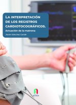 LA INTERPRETACIÓN DE LOS REGISTROS CARDIOTOCOGRÁFICOS.