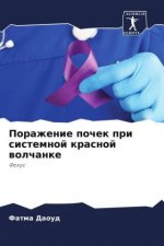 Porazhenie pochek pri sistemnoj krasnoj wolchanke