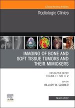 Imaging of Bone and Soft Tissue Tumors and Their Mimickers, an Issue of Radiologic Clinics of North America: Volume 60-2