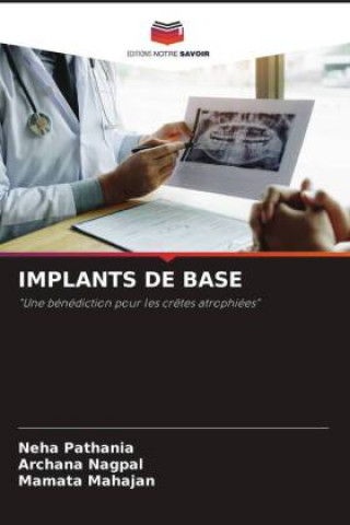 IMPLANTS DE BASE