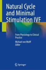 Natural Cycle and Minimal Stimulation IVF