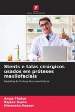 Stents e talas cirúrgicos usados   em próteses maxilofaciais
