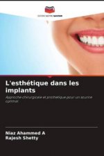 L'esthétique dans les implants