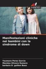 Manifestazioni cliniche nei bambini con la sindrome di down