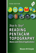 Step by Step: Reading Pentacam Topography