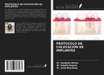 PROTOCOLO DE COLOCACIÓN DE IMPLANTES