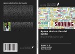 Apnea obstructiva del sue?o