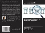 Hipomineralización de incisivos molares