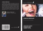 CHAPAS DENTALES