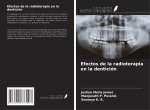 Efectos de la radioterapia en la dentición