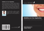 Estética en los implantes