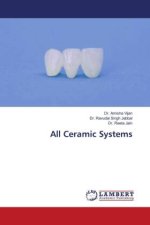 All Ceramic Systems