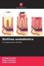 Biofilme endodôntico