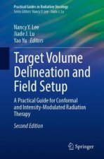 Target Volume Delineation and Field Setup