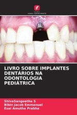 LIVRO SOBRE IMPLANTES DENTÁRIOS NA ODONTOLOGIA PEDIÁTRICA
