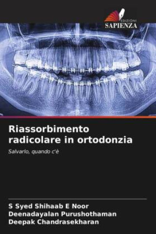 Riassorbimento radicolare in ortodonzia