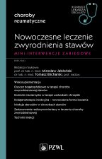 Nowoczesne leczenie zwyrodnienia stawów. Mini-interwencje zabiegowe