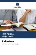 Zahnstein