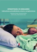 EPISIOTOMÍA VS DESGARRO