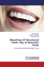 Bleaching Of Discolored Teeth: Key of Beautiful Smile